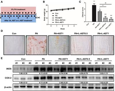 Improved Anti-Inflammatory Effects of Liposomal Astaxanthin on a Phthalic Anhydride-Induced Atopic Dermatitis Model